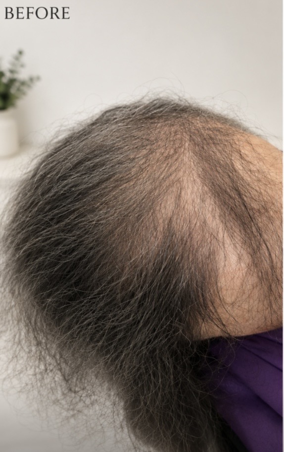 Before image of female client